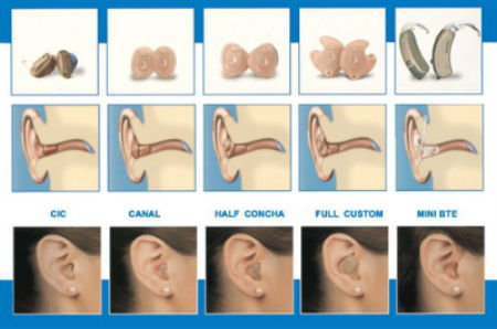 重庆助听器验配中心验配助听器是应该注意哪些问题